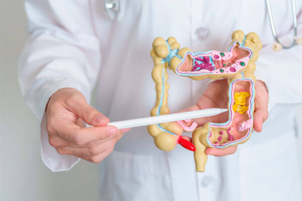 Constipação Instestinal